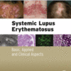 Systemic Lupus Erythematosus Basic, Applied and Clinical Aspects 2016 original pdf