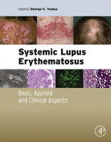 Systemic Lupus Erythematosus Basic, Applied and Clinical Aspects 2016 original pdf Systemic Lupus Erythematosus Basic, Applied and Clinical Aspects 2016 original pdf
