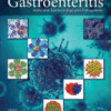 Viral Gastroenteritis Molecular Epidemiology and Pathogenesis 2016 original pdf