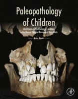 Paleopathology of Children Identification of Pathological Conditions in the Human Skeletal Remains of Non-Adults 2018 Original pdf