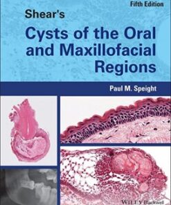 Shear's Cysts of the Oral and Maxillofacial Regions 5th Edition PDF Original 