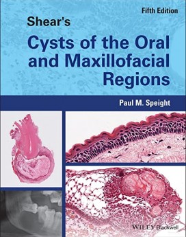 Shear's Cysts of the Oral and Maxillofacial Regions 5th Edition PDF Original