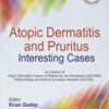 Atopic Dermatitis And Pruritus Interesting Cases original PDF   2020
