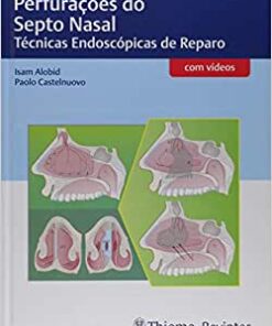 Perfurações do Septo Nasal: Técnicas Endoscópicas de Reparo (Original PDF from Publisher)