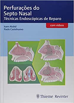 Perfurações do Septo Nasal: Técnicas Endoscópicas de Reparo (Original PDF from Publisher)