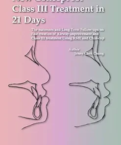 New Concept For Class III Treatment In 21 Days: The Successes And Long Term Follow-Ups On Fast Creation Of Airway Improvement And Class III Treatment Using RME And Chin-Cup (Original PDF From Publisher)