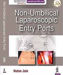 Non-Umbilical Laparoscopic Entry Ports (Original PDF from Publisher)