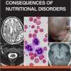 Neurological Consequences of Nutritional Disorders (Original PDF)