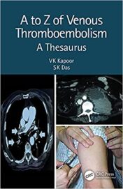 A to Z of Venous Thromboembolism: A Thesaurus Original PDF 2021