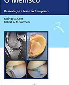 O Menisco: Da Avaliação e Lesão ao Transplante, 1st edition (Original PDF from Publisher)