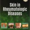 SKIN IN RHEUMATOLOGIC DISEASEs original PDF  2021