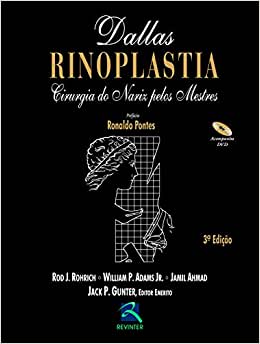 Rinoplastia: Cirurgia do Nariz Pelos Mestres, 3rd Edition (Original PDF from Publisher)