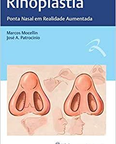 Rinoplastia: Ponta Nasal em Realidade Aumentada (Original PDF from Publisher)