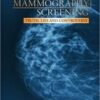 Mammography Screening (Truth, Lies and Controversy) (ORIGINAL PDF) Mammography Screening (Truth, Lies and Controversy) (ORIGINAL PDF)