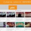 FULL SERIES CLINICAL VIDEOS DENTISTRY – GIDE FULL SERIES CLINICAL VIDEOS DENTISTRY – GIDE