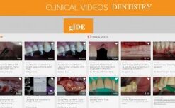 FULL SERIES CLINICAL VIDEOS DENTISTRY – GIDE