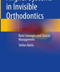 Aligner Systems in Invisible Orthodontics: Basic Concepts and Clinical Management PDF 