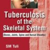 Tuberculosis Of The Skeletal System (Bones, Joints, Spine And Bursal Sheaths) Original PDF  
