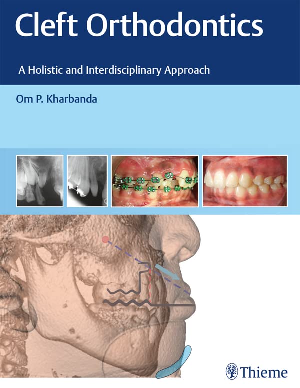 Cleft Orthodontics: A Holistic and Interdisciplinary Approach 1st Edition PDF Original