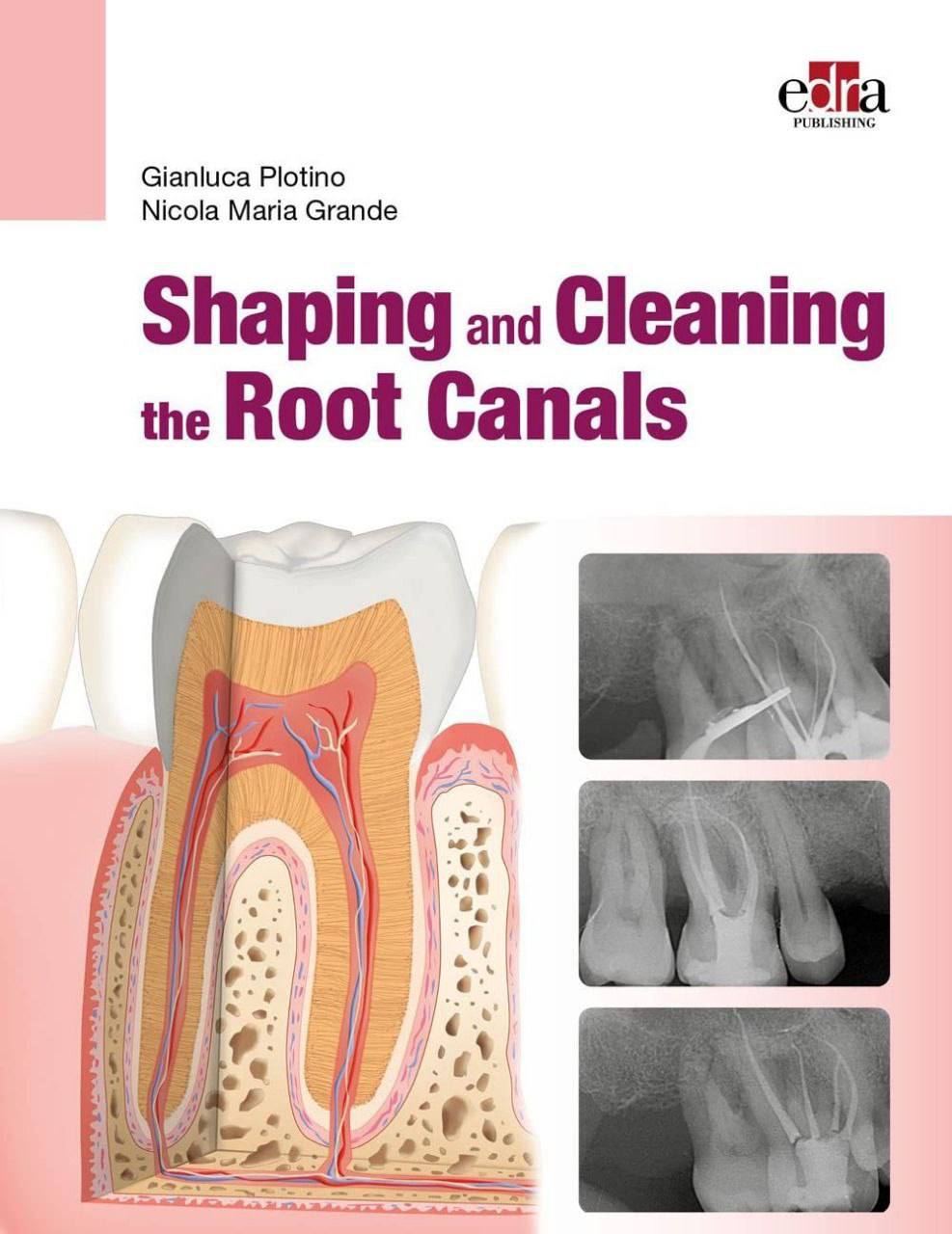SHAPING AND CLEANING THE ROOT CANALS 2023