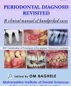 Periodontal Diagnosis Revisited: A Clinical Manual of Handpicked Cases PDF Convent