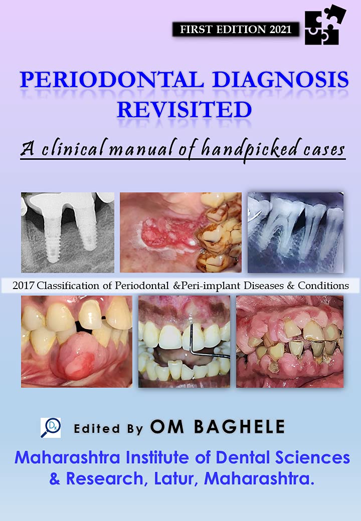 Periodontal Diagnosis Revisited: A Clinical Manual of Handpicked Cases PDF Convent