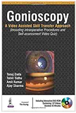 Gonioscopy:A Video Assisted Skill Transfer Approach (Videos Only)