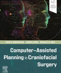 Computer-Assisted Planning in Craniofacial Surgery PDF 