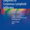 Diagnosis of Cutaneous Lymphoid Infiltrates A Visual Approach to Differential Diagnosis and Knowledge Gaps 2019 ORIGINAL PDF