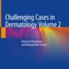 Challenging Cases in Dermatology Volume 2 Advanced Diagnoses and Management Tactics 2019 ORIGINAL PDF