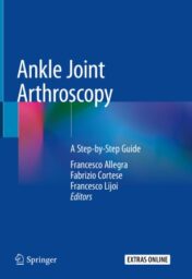 Ankle Joint Arthroscopy A Step-by-Step Guide 2020 Original pdf