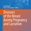 Diseases of the Breast during Pregnancy and Lactation 2020 Original pdf