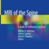 MRI of the Spine A Guide for Orthopedic Surgeons 2020 Original pdf