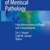 The Management of Meniscal Pathology From Meniscectomy to Repair and Transplantation 2020 Original pdf The Management of Meniscal Pathology From Meniscectomy to Repair and Transplantation 2020 Original pdf