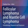Follicular Lymphoma and Mantle Cell Lymphoma Original PDF 2020