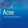 Acne Current Concepts and Management 2021 ORIGINAL PDF
