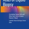 Atlas of Liquid Biopsy Circulating Tumor Cells and Other Rare Cells in Cancer Patients’ Blood 2021 Original pdf