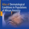 Atlas of Dermatological Conditions in Populations of African Ancestry 2021 ORIGINAL PDF