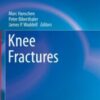 2022 Knee Fractures (Strategies in Fracture Treatments) 2021 Original PDF 2022 Knee Fractures (Strategies in Fracture Treatments) 2021 Original PDF