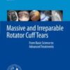 Massive and Irreparable Rotator Cuff Tears From Basic Science to Advanced Treatments 2020 Original pdf