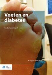 Voeten en diabetes(original pdf)