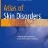 Atlas of Skin Disorders Challenging Presentations of Common to Rare Conditions 2018 ORIGINAL PDF