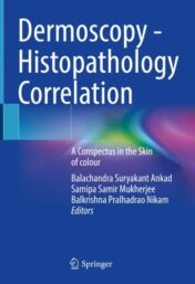 Dermoscopy – Histopathology Correlation A Conspectus in the Skin of colour 2021 ORIGINAL PDF