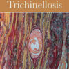 Trichinella and Trichinellosis Original PDF 