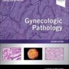 Gynecologic Pathology: A Volume in Foundations in Diagnostic Pathology Series, 2nd Edition 