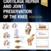 Cartilage Repair and Joint Preservation of the Knee, 2nd Edition 2021 ORIGINAL PDF Cartilage Repair and Joint Preservation of the Knee, 2nd Edition 2021 ORIGINAL PDF