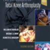 The Technique of Total Knee Arthroplasty, 2nd edition 20222 Original PDF The Technique of Total Knee Arthroplasty, 2nd edition 20222 Original PDF