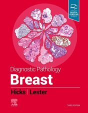 Diagnostic Pathology: Breast, 3rd Edition 2021 Original PDF