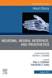 Neuroma, Neural interface, and Prosthetics, An Issue of Hand Clinics (Volume 37-3) (The Clinics: Orthopedics, Volume 37-3) (Original PDF from Publisher)