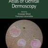 Atlas of Genital Dermoscopy Original PDF